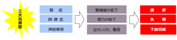 合併症のイメージ画像