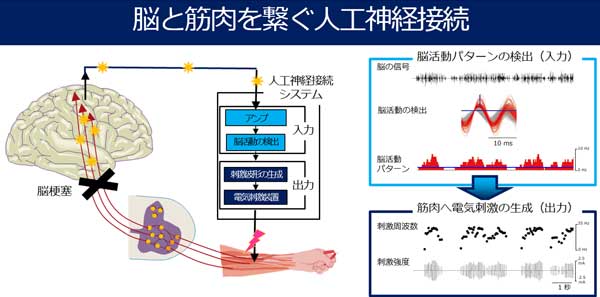 人工神経接続に関するイメージ画像1