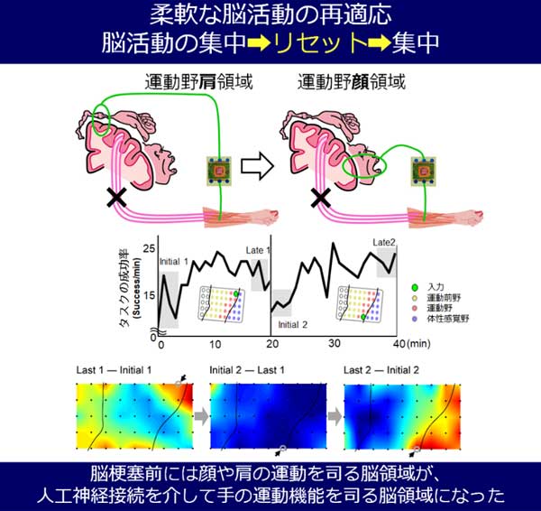 人工神経接続に関するイメージ画像3