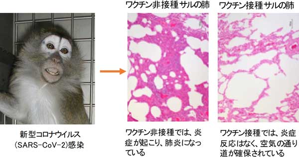 ワクチン有効性・安全性の概要図